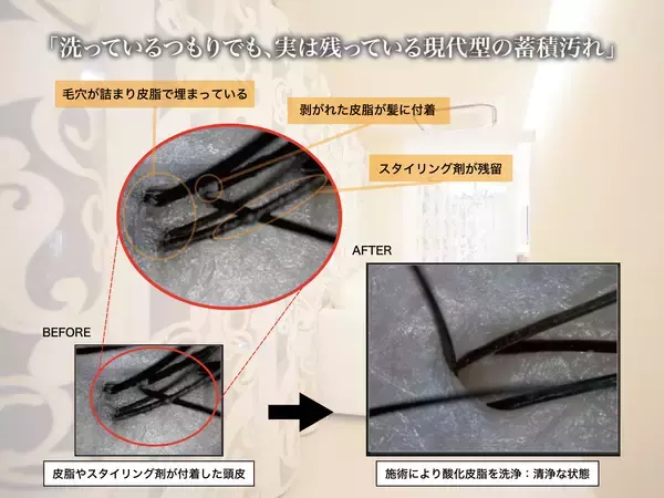 「「ひとときのしずく」が“頭皮のにおい”について調査　30代女性の76％が“夕方頭皮臭”に悩み　来店客250名に聞いた、においの現状と2～4月に最大化する「酸化皮脂」の蓄積リスクとケア」の画像