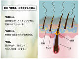 「「ひとときのしずく」が“頭皮のにおい”について調査　30代女性の76％が“夕方頭皮臭”に悩み　来店客250名に聞いた、においの現状と2～4月に最大化する「酸化皮脂」の蓄積リスクとケア」の画像4