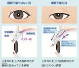 「医療法人社団 岡田クリニック 眼科・緑内障・糖尿病、アップニークミニ点眼液による「眼瞼下垂」治療を開始」の画像2