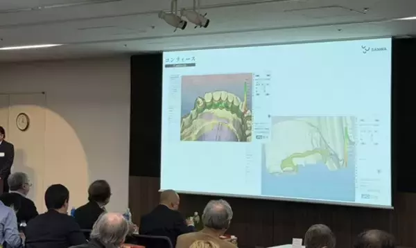 「熟練の技工と最新技術によってたどり着いた、アナログとデジタルの融合　未来へ歩み続けるデンチャーのパートナー「Livion(リヴィオン)」が誕生」の画像