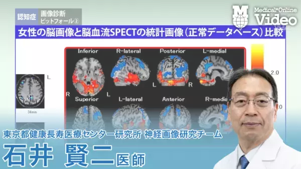 「医療動画配信「Medical*Online Video」抗アミロイド抗体薬時代の認知症診療を学ぶ新シリーズを公開」の画像