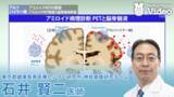 「医療動画配信「Medical*Online Video」抗アミロイド抗体薬時代の認知症診療を学ぶ新シリーズを公開」の画像3