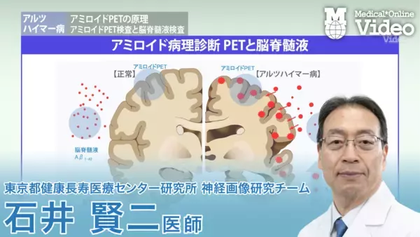 「医療動画配信「Medical*Online Video」抗アミロイド抗体薬時代の認知症診療を学ぶ新シリーズを公開」の画像