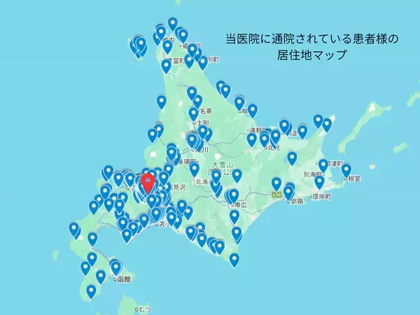 「相次ぐ公共機関の減便や廃止は、通院にも影響　乗り継ぎに便利な旭川駅前広場で4/16(木)入れ歯の無料相談会開催」の画像