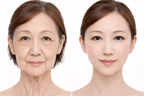 「東海地方初導入　名古屋・栄で進化するたるみ治療　まゆりなclinic名古屋栄、次世代高周波治療器「ATTIVA(アッティバ)導入」」の画像