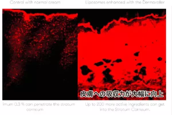 「朝倉 未来プロデュース「VO-VO-」×ダーマローラージャパン」の画像