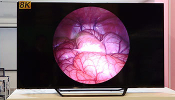 遠隔オペが現実に、5Gで見えてきた未来の「モバイル手術室」