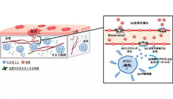 「じんましん」を数式で表現することに成功、広島大学