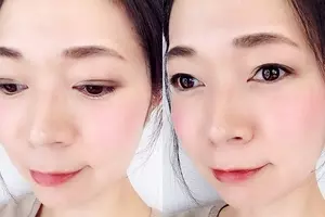 一重 奥二重さんは 鼻下鏡 でデカ目に ぼんやり目元から卒業できる裏ワザ 17年4月19日 エキサイトニュース