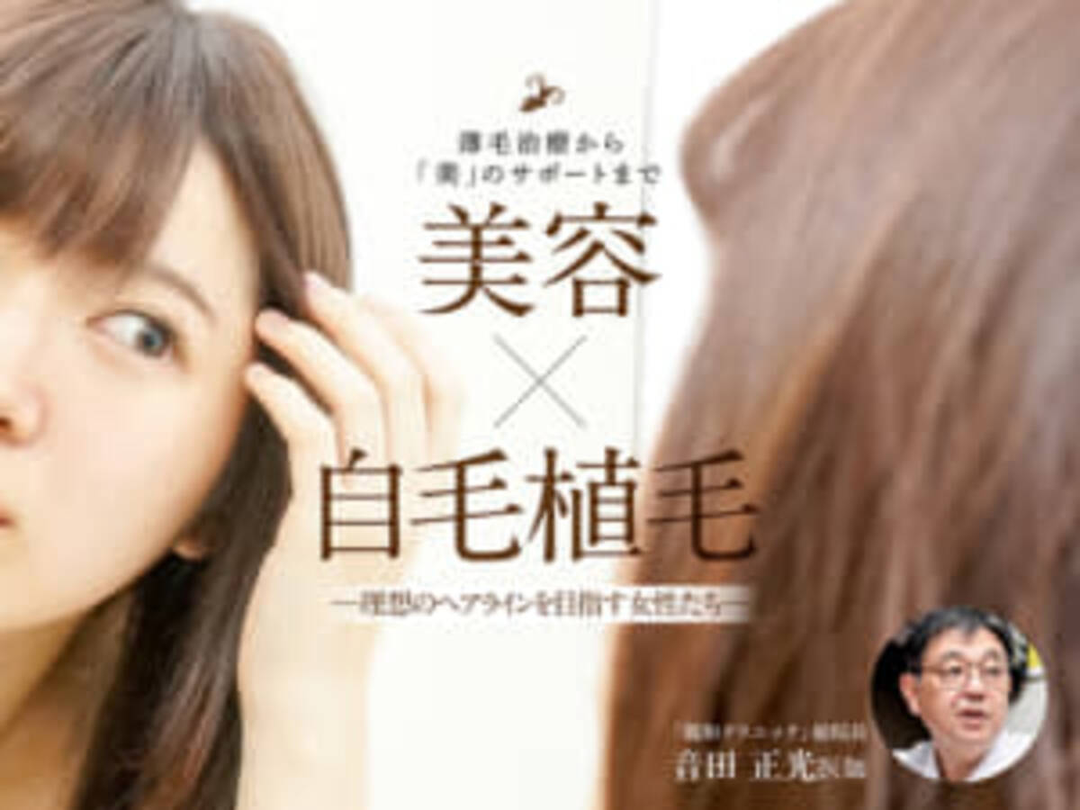 自毛植毛 治療も美容も 理想のヘアラインを求めて自毛植毛を選ぶ女性たち 21年3月31日 エキサイトニュース 自毛植毛 治療も美容も 理想のヘアラインを求めて自毛植毛を選ぶ女性たち 21年3月31日 エキサイトニュース
