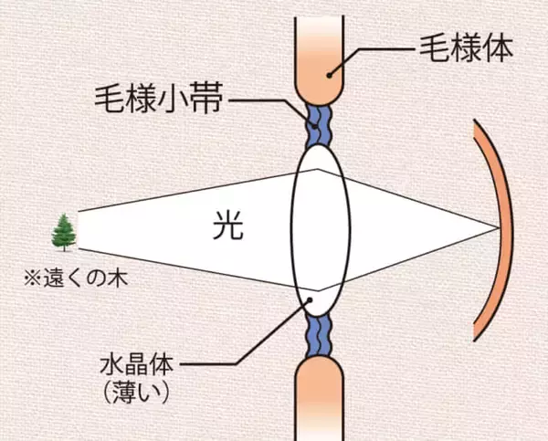 「現代病「スマホ老眼」に要注意！」の画像