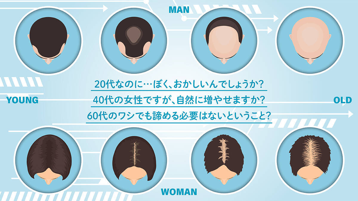 植毛の進化論 髪は 増えればいい時代 から 人生を変える時代 へ 自毛植毛で未来を切り拓いた老若男女たち 年2月21日 エキサイトニュース