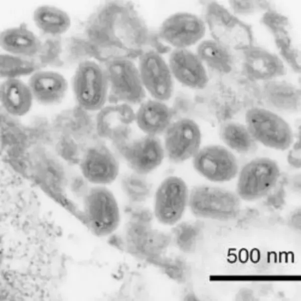 「伊達政宗が独眼竜になったのは、あのウイルスが原因だった！？～江戸時代の感染症のホント～」の画像