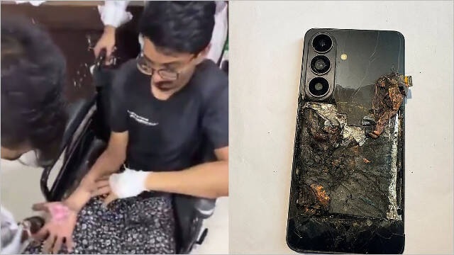 【注意】Galaxy S26いきなり爆発、服にも引火し両手や性器を大火傷する惨事に