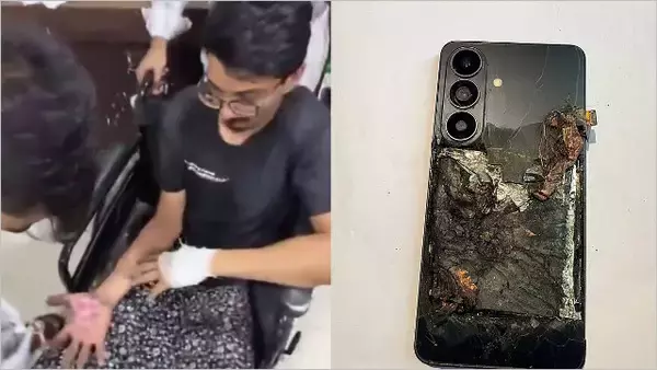 「【注意】Galaxy S26いきなり爆発、服にも引火し両手や性器を大火傷する惨事に」の画像