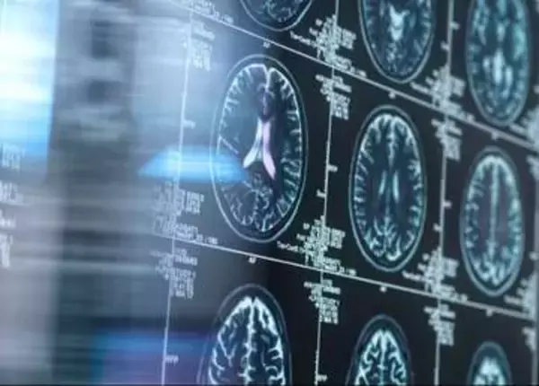 高齢の脳、リチウムでアルツハイマー病防げる可能性　25年研究