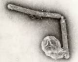 「鳥インフルエンザで入院の患者、これまで人で未確認のウイルス株検出　米ワシントン州」の画像1