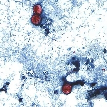 米で流行の寄生虫感染症、初の死者確認　ミシガン州で2人死亡