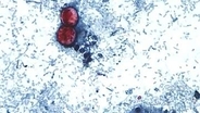 激しい下痢を起こす寄生虫感染症、米国で昨年をはるかに上回る症例数　野菜が原因との見方も