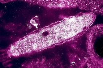 米ニューヨーク市でレジオネラ症の集団感染、3人の死亡報告