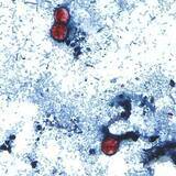 「寄生虫感染症の集団感染、さらに4州で確認　レタスが感染源か　米CDC」の画像1
