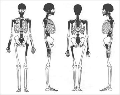 鉄器時代のスコットランドの女性、埋葬前に脳をすくい取られていた可能性　新研究