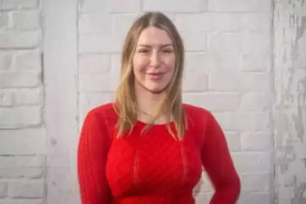 女性の植毛手術が急増中、ただしその成功率は――