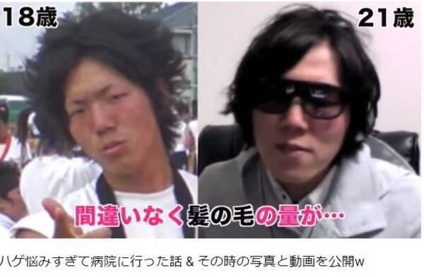 ヒカキン ハゲに悩み病院に行った過去明かす 医師は 気にしすぎ と一蹴 19年6月21日 エキサイトニュース