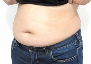 肥満が多い都道府県ランキング1位青森県 「周りから指摘されるまで体型を意識しない傾向」