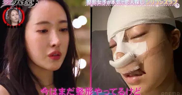 「整形をやめたい」　総額600万円を費やした女性が涙ながらに吐露した期待と不安