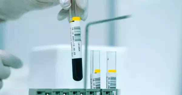 心臓の血管、どこまで傷んでいる?──医師が勧める3段階チェック法