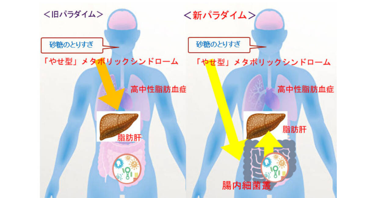 メタボにつながる脂質代謝の異常は腸内環境の変化が原因 名大が解明 21年3月29日 エキサイトニュース