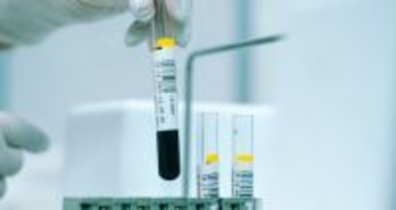 O型はがんになりにくい? 100万人を調査して分かった、血液型と発症リスクの差