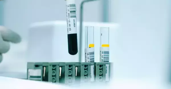 「健康的なつもり」が危ない？ 血糖値スパイクにつながる食習慣とは