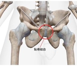 【医師に相談】恥骨結合炎（恥骨炎）とはどのような病気ですか？