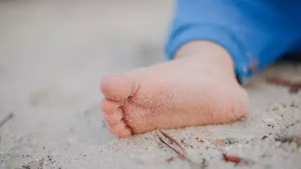 「足の裏のホクロ」は注意！病気の可能性も