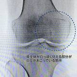 「【医師に相談】変形性膝関節症とは何ですか？」の画像2