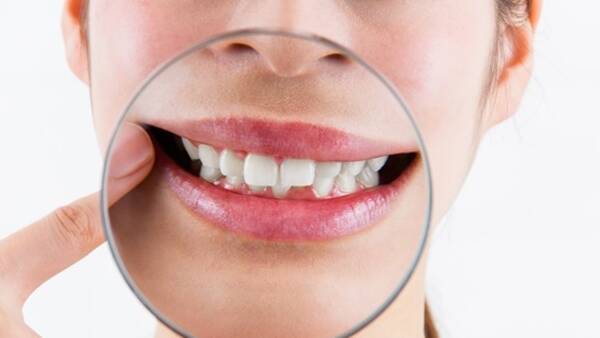 歯ぐきの黒ずみを治したい 原因と治療法を知ろう 21年2月6日 エキサイトニュース