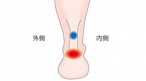 アキレス腱の痛みは不要な血管のせい 21年10月11日 エキサイトニュース