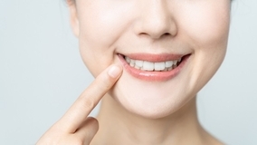 芸能人にも多いガミースマイル 原因と治療法を徹底解説 21年3月23日 エキサイトニュース 芸能人にも多いガミースマイル 原因と治療法を徹底解説 21年3月23日 エキサイトニュース