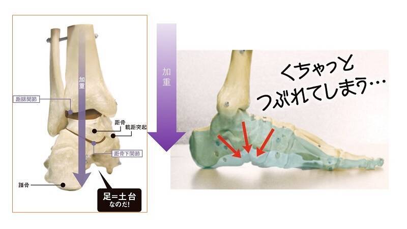 その疲れやトラブル 足のアーチが原因かも 18年2月14日 エキサイトニュース 2 4