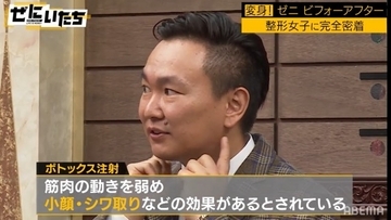 総額560万円の美容整形ビフォーアフターにかまいたち感動「これはすごいよ」