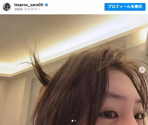 南沙良、“寝癖”を披露　「鬼太郎」「素晴らしい」「可愛すぎる」