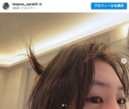 南沙良、“寝癖”を披露　「鬼太郎」「素晴らしい」「可愛すぎる」