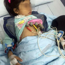 園児53名が体調不良に……中国の保育園で、給食への「劇薬混入テロ」が続発中