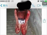 「韓国の女子中学生が後輩を壮絶リンチ、血まみれに……　被害少女「2カ月前にも暴行されていた」　」の画像1
