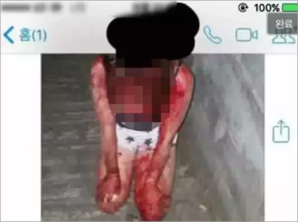 「韓国の女子中学生が後輩を壮絶リンチ、血まみれに……　被害少女「2カ月前にも暴行されていた」　」の画像