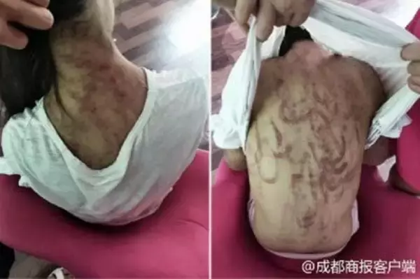 被害女児「慣れすぎて涙も出ない」……中国で継母による児童虐待が相次ぐ