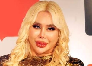 アレン様「全財産をカジノで失う」「1日1回バッグを替えても使えない」1億円の美容整形も話題に　散財ぶりが規格外