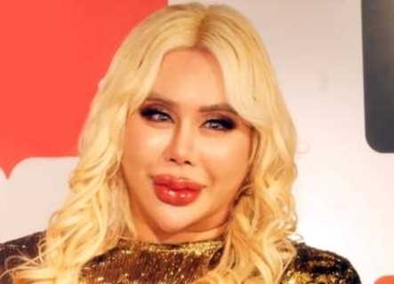 アレン様「全財産をカジノで失う」「1日1回バッグを替えても使えない」1億円の美容整形も話題に　散財ぶりが規格外